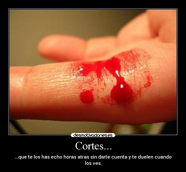 Cortes... - ...que te los has echo horas atras sin darte cuenta y te duelen cuando los ves.