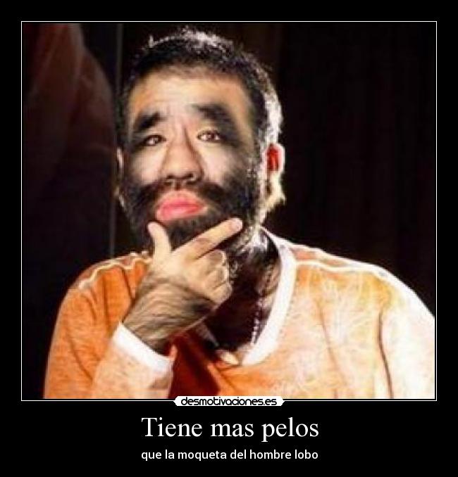 Tiene mas pelos - que la moqueta del hombre lobo