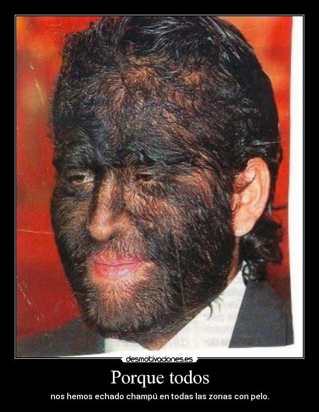 Porque todos - nos hemos echado champú en todas las zonas con pelo.