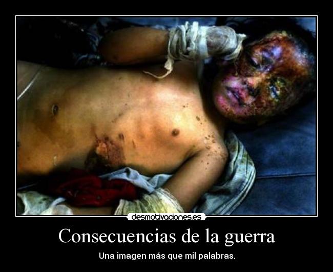 Consecuencias de la guerra -