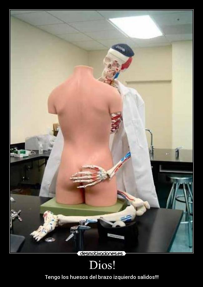 Dios! - Tengo los huesos del brazo izquierdo salidos!!!