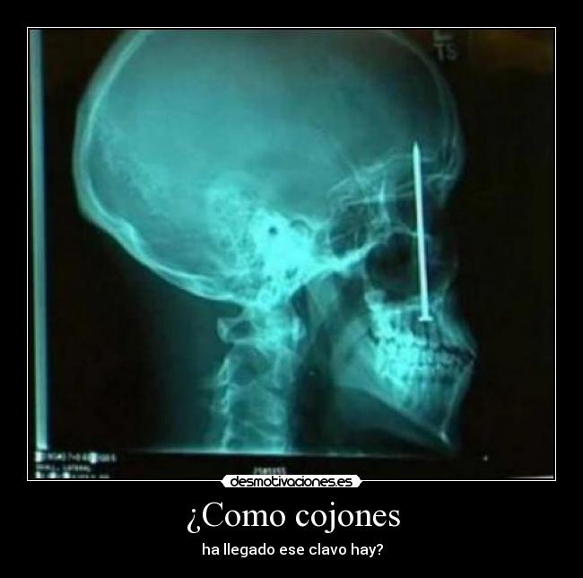 ¿Como cojones - ha llegado ese clavo hay?