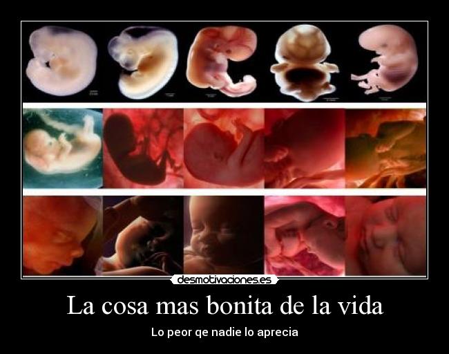 La cosa mas bonita de la vida -