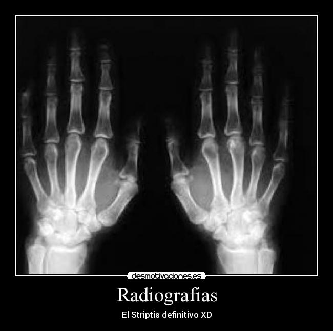 Radiografias -
