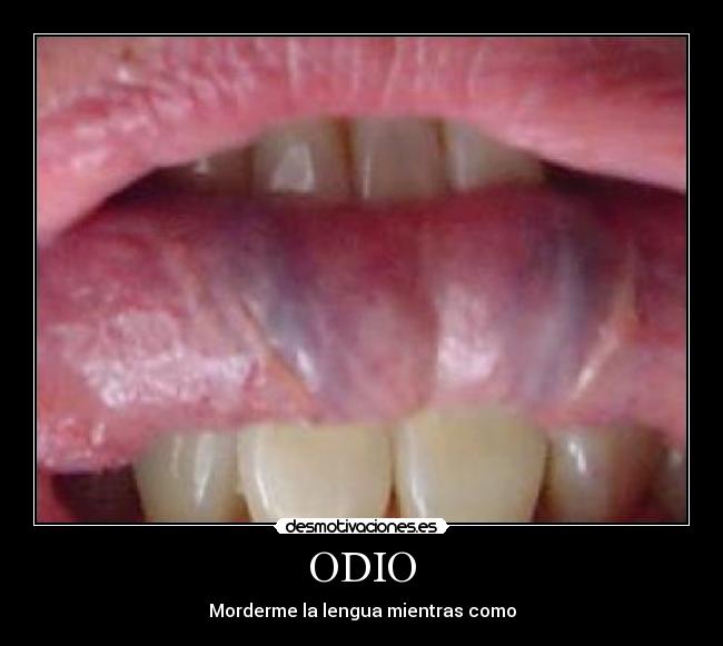 ODIO - Morderme la lengua mientras como