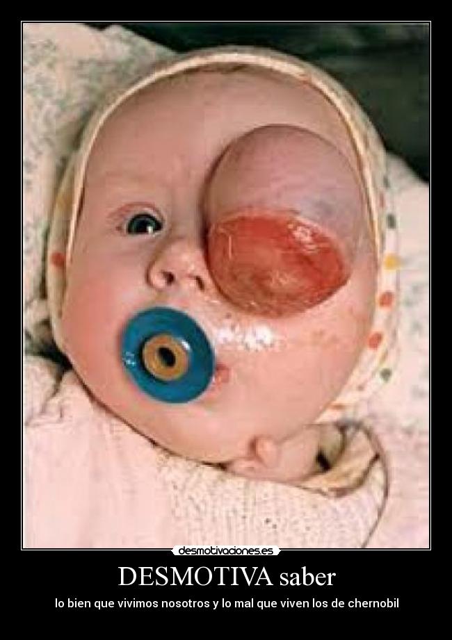 DESMOTIVA saber - lo bien que vivimos nosotros y lo mal que viven los de chernobil
