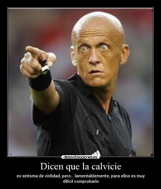 Dicen que la calvicie - es síntoma de virilidad, pero... lamentablemente, para ellos es muy difícil comprobarlo