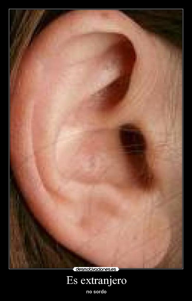Es extranjero - no sordo