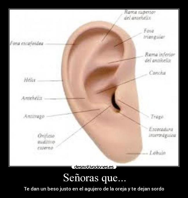 Señoras que... - Te dan un beso justo en el agujero de la oreja y te dejan sordo