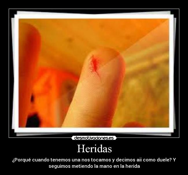 Heridas - ¿Porqué cuando tenemos una nos tocamos y decimos aii como duele? Y
seguimos metiendo la mano en la herida