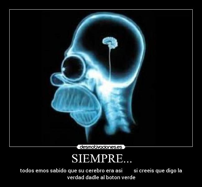 SIEMPRE... - todos emos sabido que su cerebro era asi         si creeis que digo la
verdad dadle al boton verde