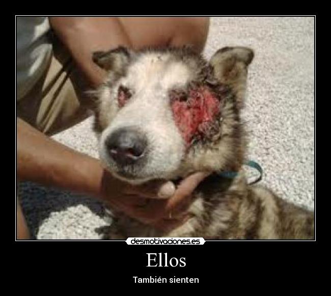 Ellos - También sienten