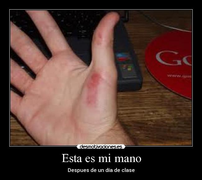 Esta es mi mano - 