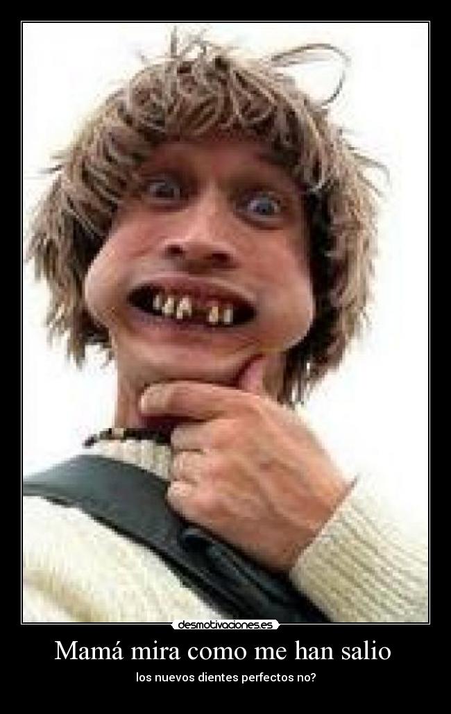 Mamá mira como me han salio  - 
