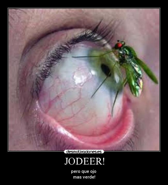 JODEER! -