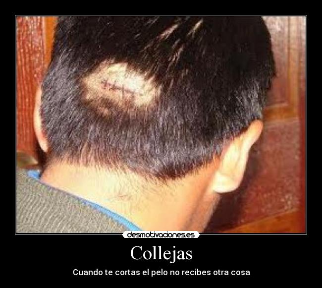 Collejas - Cuando te cortas el pelo no recibes otra cosa