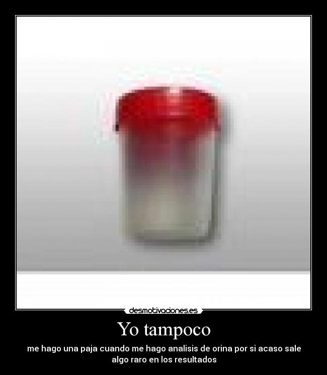 Yo tampoco - me hago una paja cuando me hago analisis de orina por si acaso sale
algo raro en los resultados