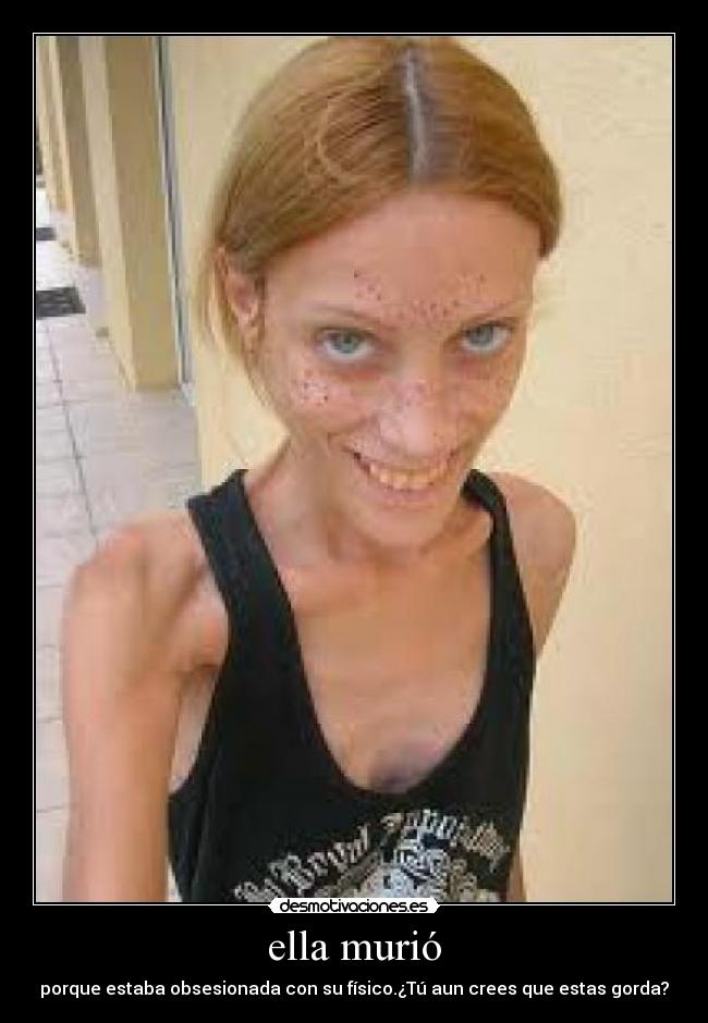 ella murió - porque estaba obsesionada con su físico.¿Tú aun crees que estas gorda?