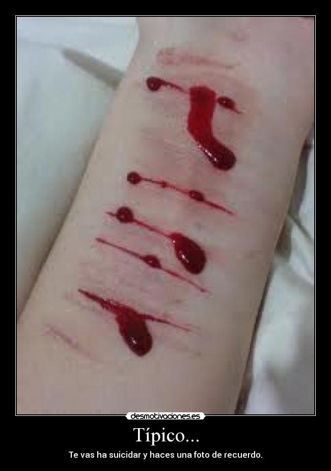 Típico... - Te vas ha suicidar y haces una foto de recuerdo.