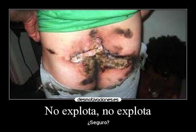 No explota, no explota -