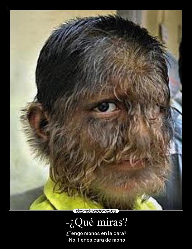 -¿Qué miras? - 