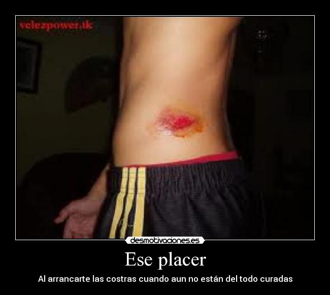 Ese placer - Al arrancarte las costras cuando aun no están del todo curadas