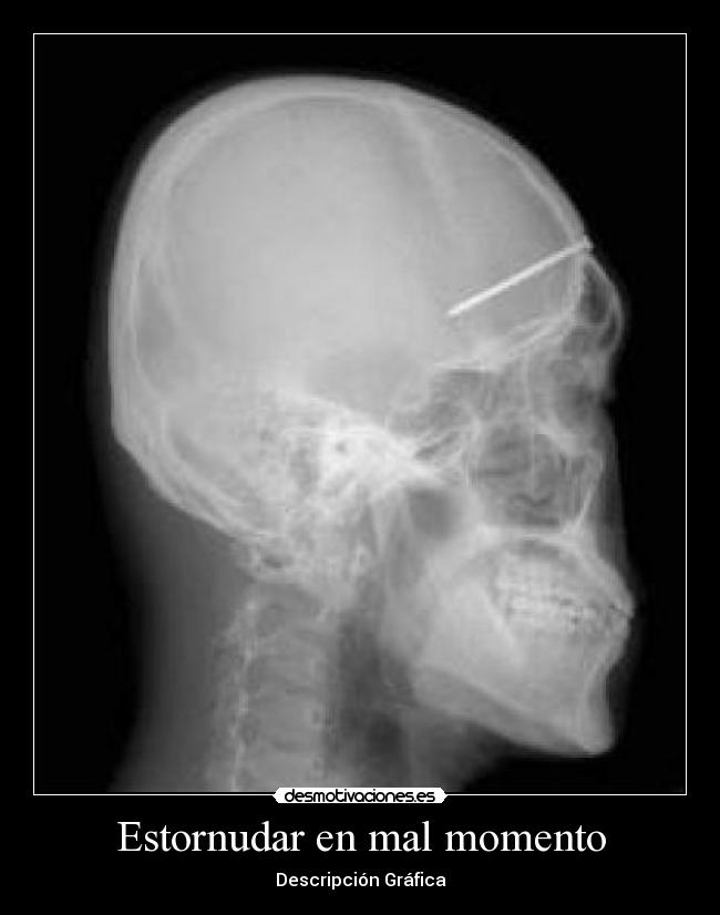 Estornudar en mal momento - Descripción Gráfica