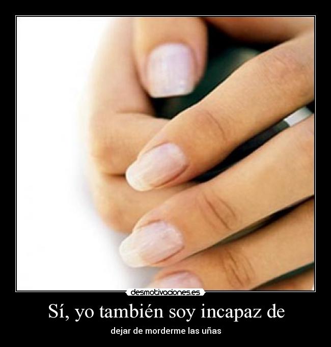 Sí, yo también soy incapaz de -