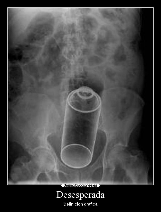 Desesperada - Definicion grafica