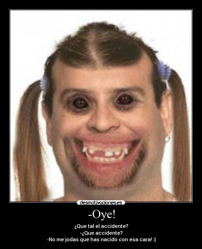 -Oye! - ¿Que tal el accidente?
-¿Que accidente?
-No me jodas que has nacido con esa cara! :|