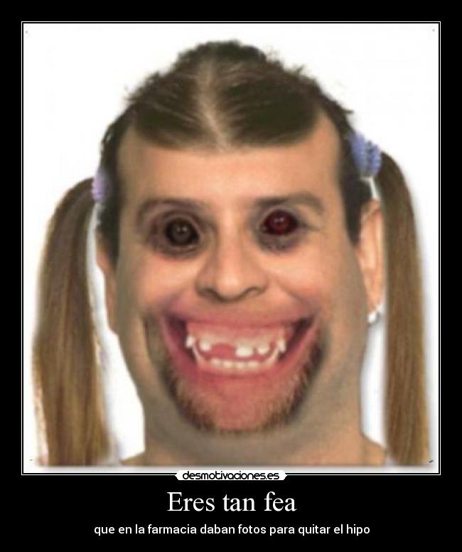 Eres tan fea - que en la farmacia daban fotos para quitar el hipo