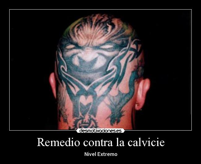 Remedio contra la calvicie -