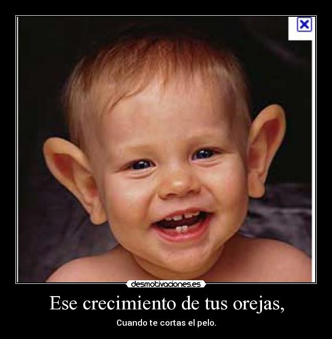 Ese crecimiento de tus orejas, - 