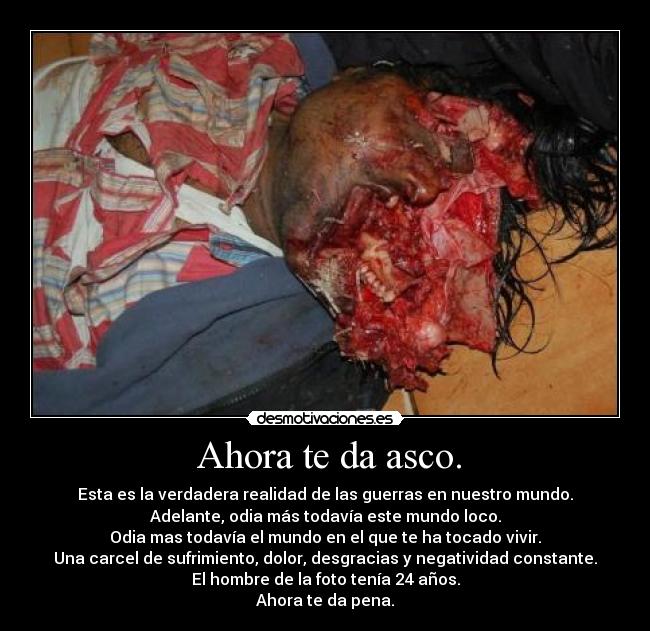  Ahora te da asco. - Esta es la verdadera realidad de las guerras en nuestro mundo.
Adelante, odia más todavía este mundo loco.
Odia mas todavía el mundo en el que te ha tocado vivir.
Una carcel de sufrimiento, dolor, desgracias y negatividad constante.
El hombre de la foto tenía 24 años.
Ahora te da pena.