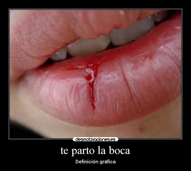 te parto la boca - Definición gráfica