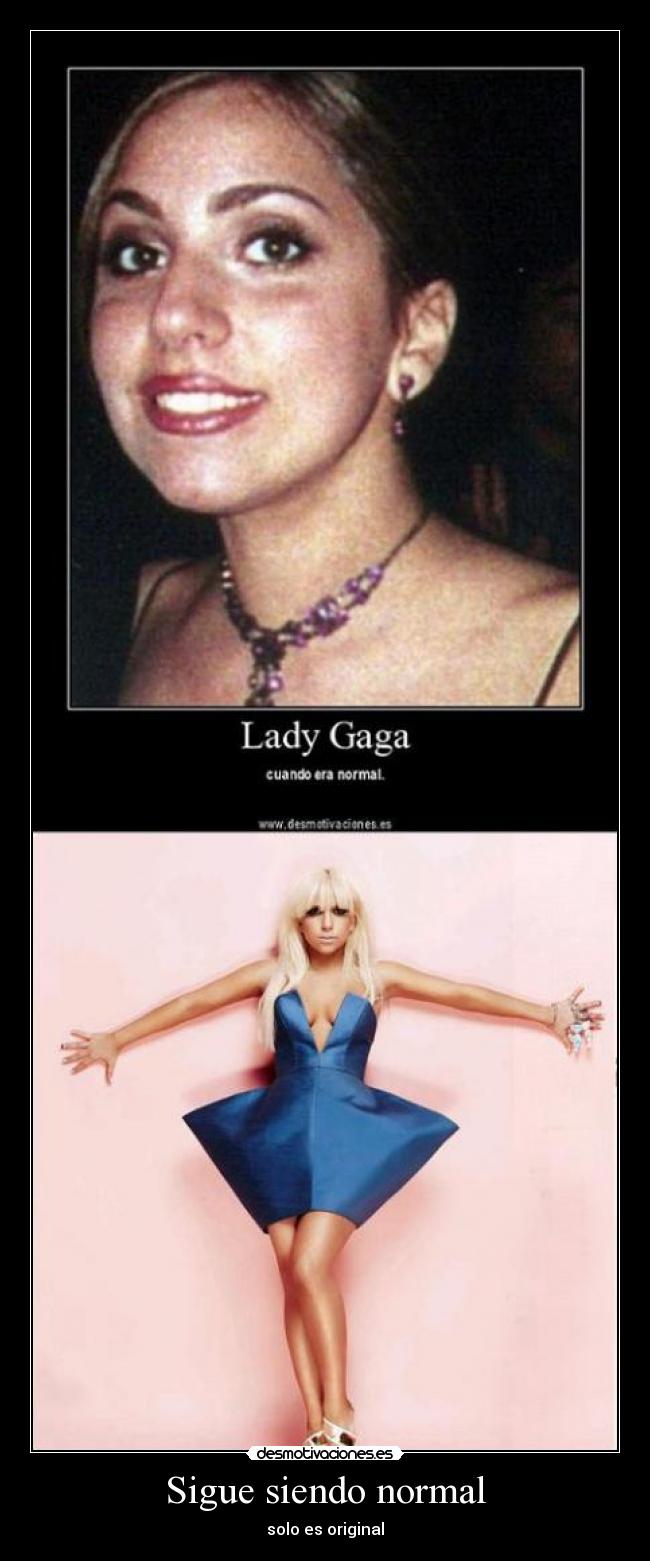 Sigue siendo normal -