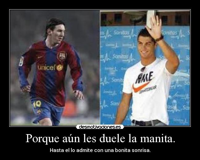 Porque aún les duele la manita. - 