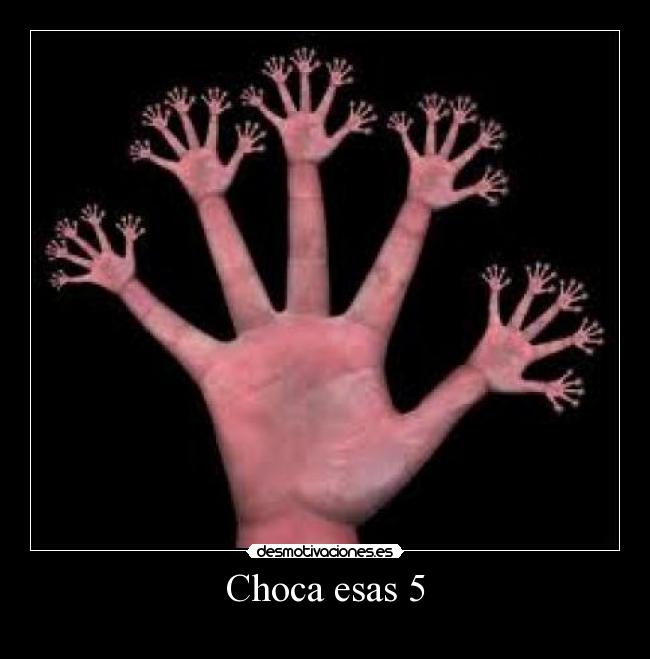 Choca esas 5 - 