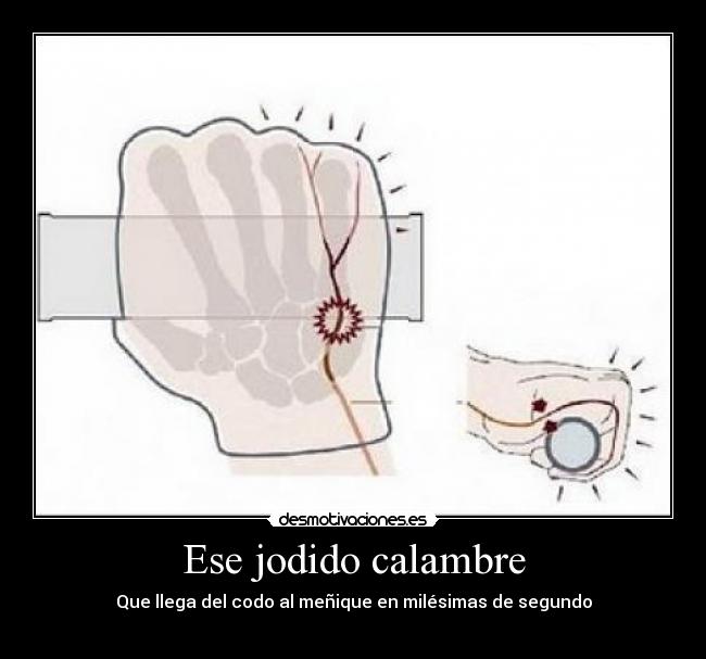 Ese jodido calambre - 
