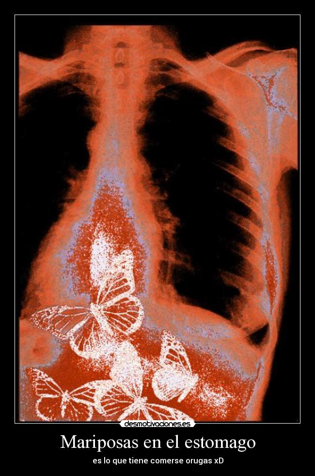 Mariposas en el estomago - 