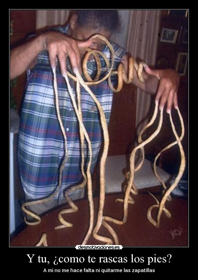 Y tu, ¿como te rascas los pies? - A mi no me hace falta ni quitarme las zapatillas
