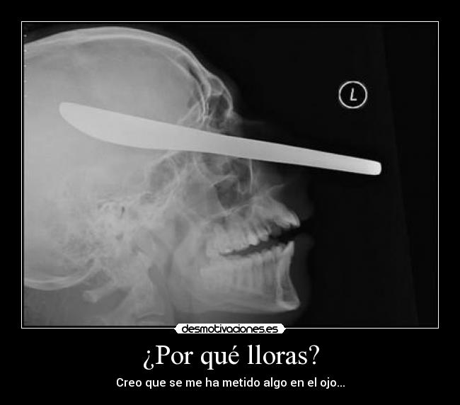 ¿Por qué lloras? - Creo que se me ha metido algo en el ojo...