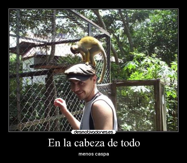 En la cabeza de todo - menos caspa