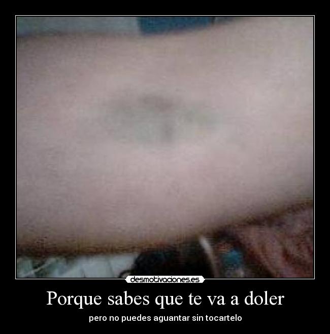 Porque sabes que te va a doler -