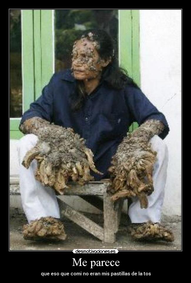 Me parece - que eso que comi no eran mis pastillas de la tos