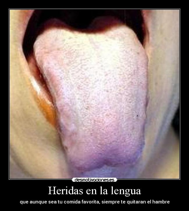 Heridas en la lengua -