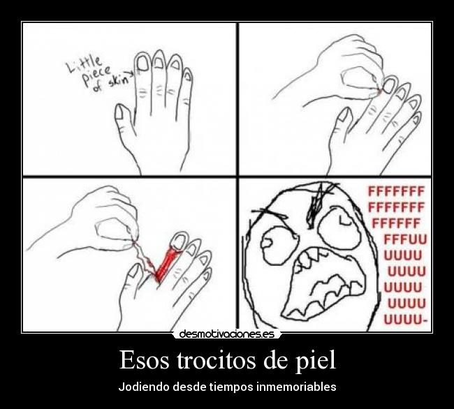 Esos trocitos de piel -