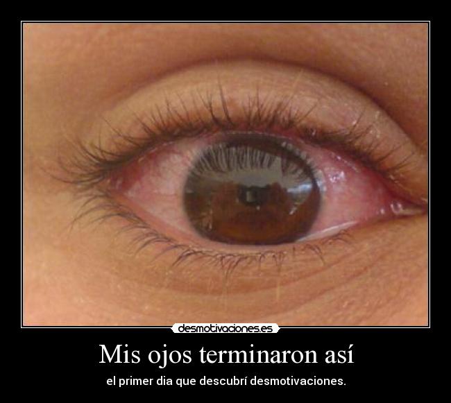 Mis ojos terminaron así - el primer dia que descubrí desmotivaciones.