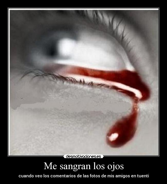 Me sangran los ojos - 