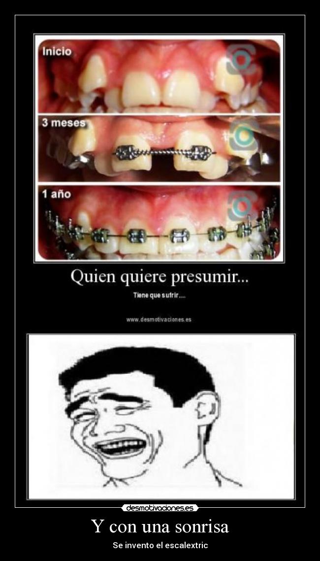 carteles sonrisa yao ming javilito escalextric dientes aparato feo despollo desmotivaciones